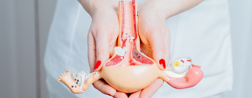 endometriose