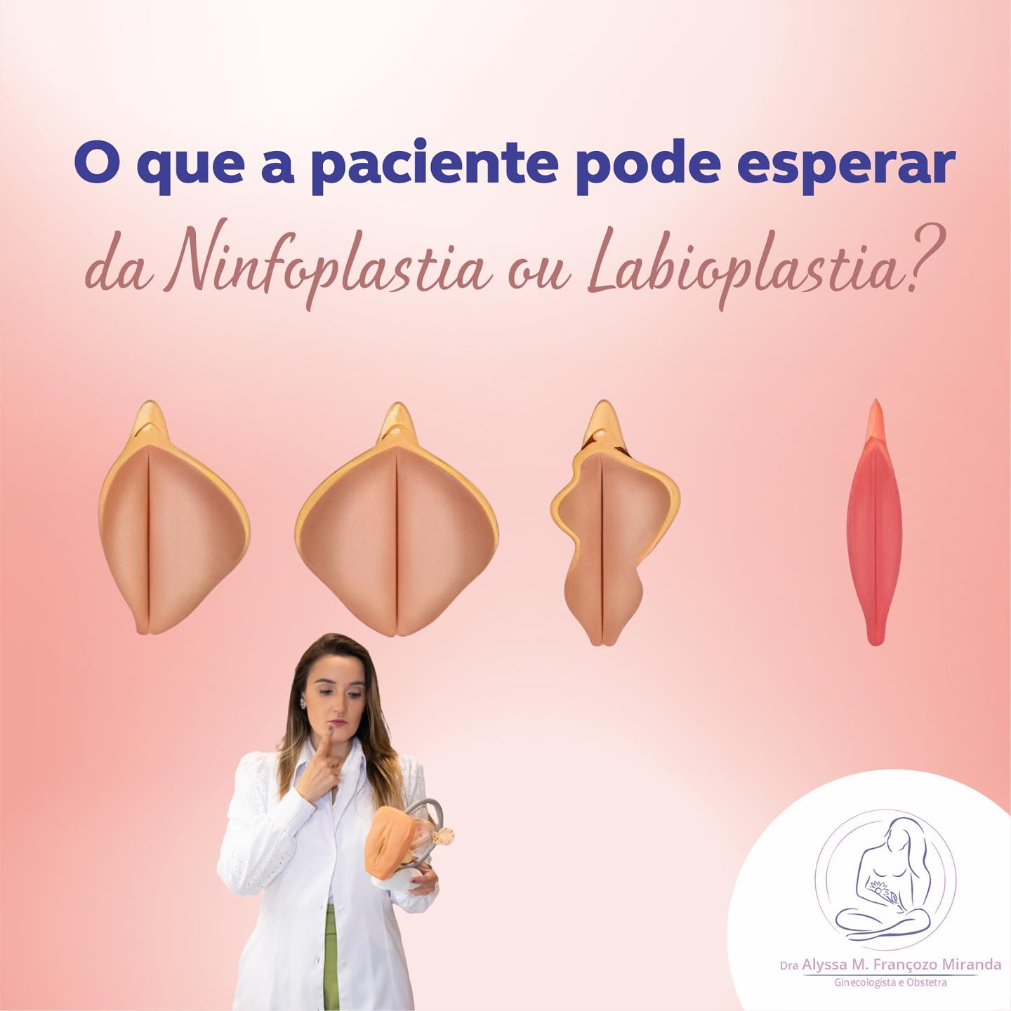 Benefícios e Expectativas da Ninfoplastia e Labioplastia